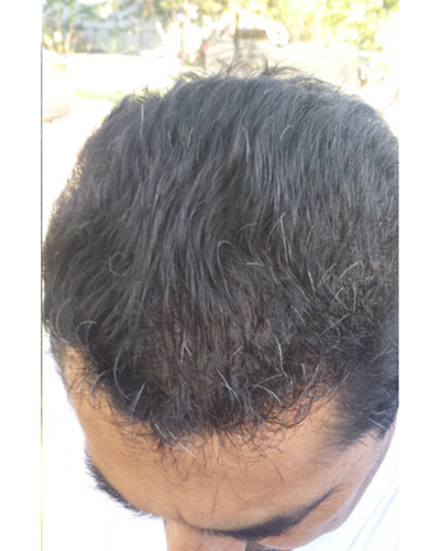 After using Semis Shampoo