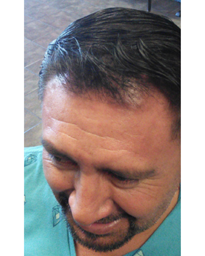 After using Semis Shampoo