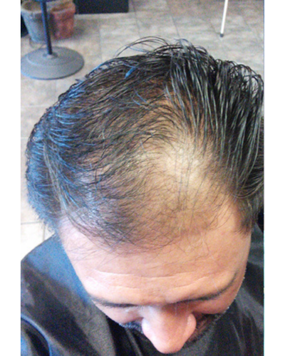 Before using Semis Shampoo